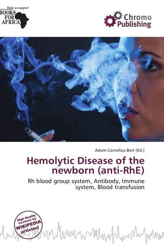 Hemolytic Disease of the newborn (anti-RhE)