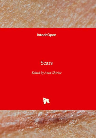 Scars