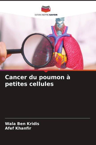 Cancer du poumon à petites cellules