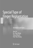 Special Type of Finger Replantation