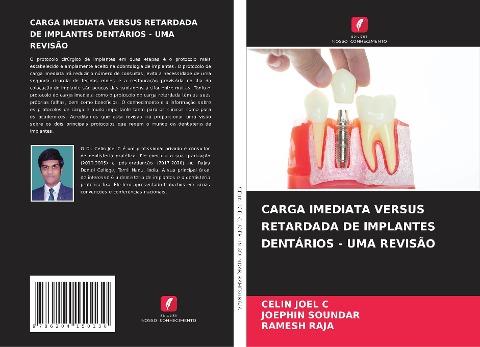 CARGA IMEDIATA VERSUS RETARDADA DE IMPLANTES DENTÁRIOS - UMA REVISÃO