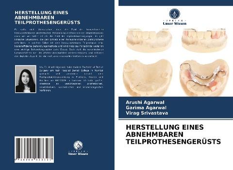 HERSTELLUNG EINES ABNEHMBAREN TEILPROTHESENGERÜSTS
