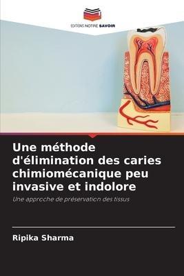Une méthode d'élimination des caries chimiomécanique peu invasive et indolore