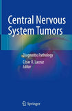 Central Nervous System Tumors