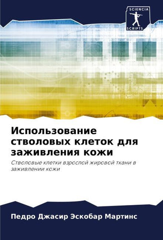 Ispol'zowanie stwolowyh kletok dlq zazhiwleniq kozhi