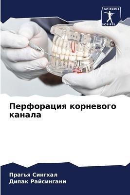 Perforaciq kornewogo kanala