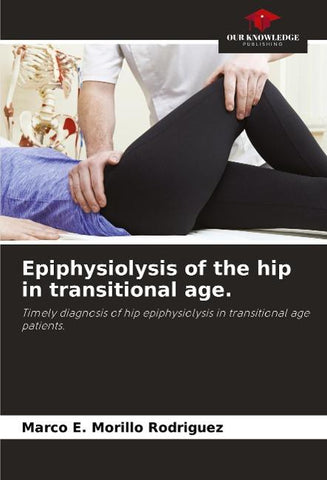 Epiphysiolysis of the hip in transitional age.