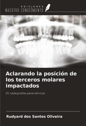 Aclarando la posición de los terceros molares impactados