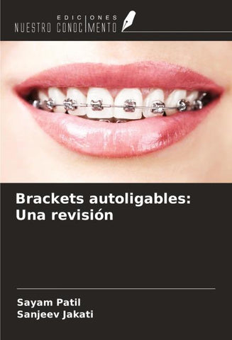 Brackets autoligables: Una revisión