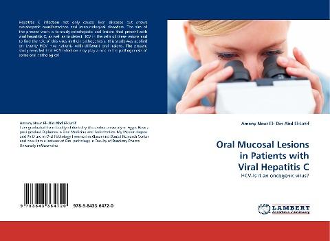Oral Mucosal Lesions in Patients  with Viral Hepatitis C