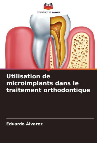 Utilisation de microimplants dans le traitement orthodontique