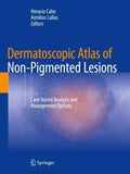 Dermatoscopic Atlas of Non-Pigmented Lesions