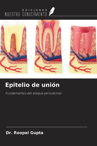 Epitelio de unión