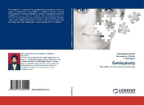 Genioplasty