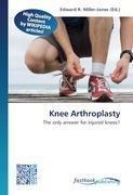 Knee Arthroplasty