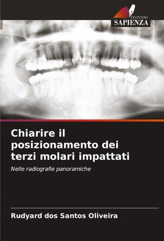 Chiarire il posizionamento dei terzi molari impattati