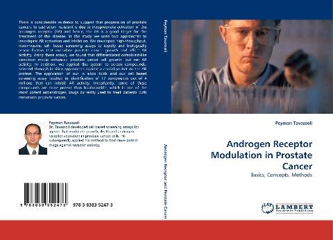 Androgen Receptor Modulation in Prostate Cancer
