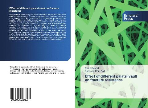 Effect of different palatal vault on fracture resistance