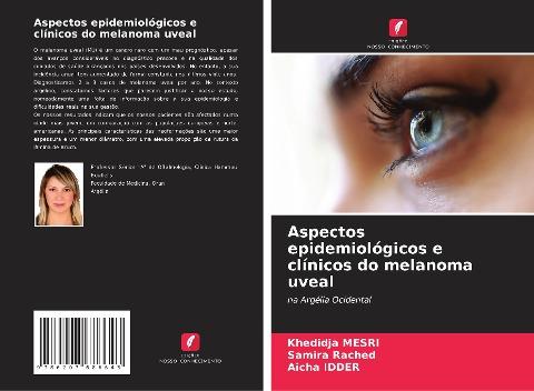 Aspectos epidemiológicos e clínicos do melanoma uveal