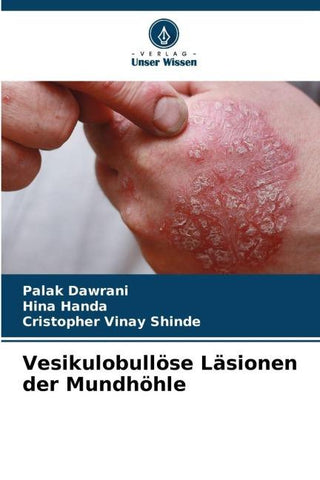 Vesikulobullöse Läsionen der Mundhöhle