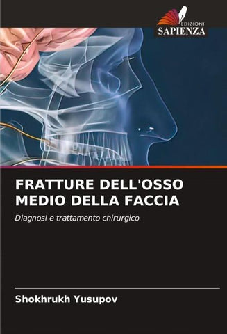 FRATTURE DELL'OSSO MEDIO DELLA FACCIA