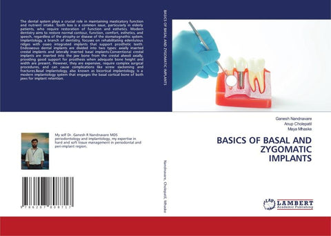 BASICS OF BASAL AND ZYGOMATIC IMPLANTS