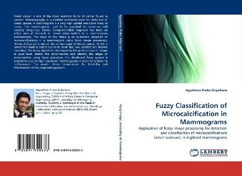 Fuzzy Classification of Microcalcification in Mammograms