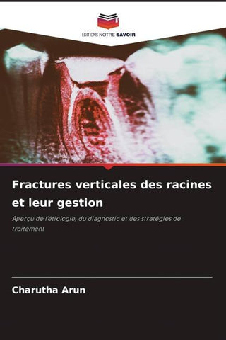 Fractures verticales des racines et leur gestion