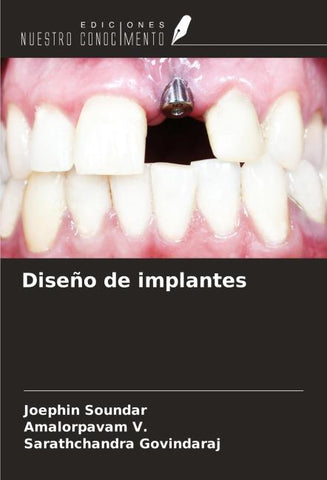 Diseño de implantes