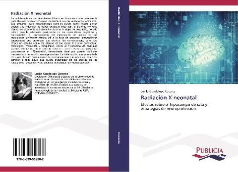 Radiación X neonatal