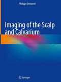 Imaging of the Scalp and Calvarium