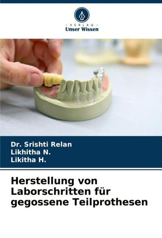Herstellung von Laborschritten für gegossene Teilprothesen
