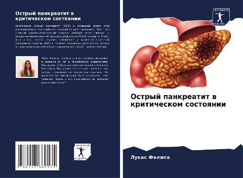 Ostryj pankreatit w kriticheskom sostoqnii