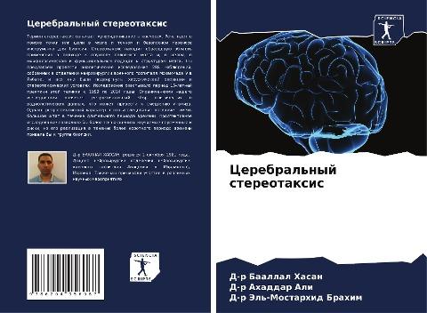 Cerebral'nyj stereotaxis