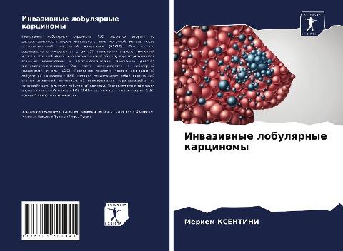 Inwaziwnye lobulqrnye karcinomy