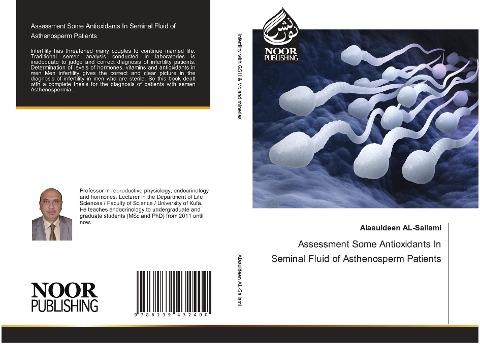 Assessment Some Antioxidants In Seminal Fluid of Asthenosperm Patients