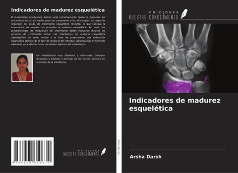 Indicadores de madurez esquelética