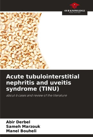 Acute tubulointerstitial nephritis and uveitis syndrome (TINU)