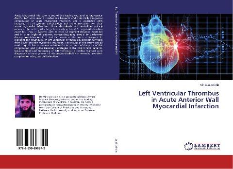 Left Ventricular Thrombus in Acute Anterior Wall Myocardial Infarction