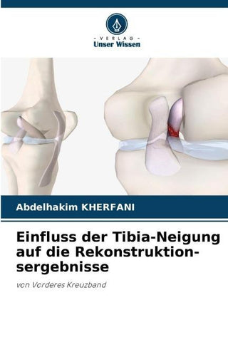 Einfluss der Tibia-Neigung auf die Rekonstruktion-sergebnisse