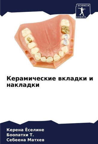 Keramicheskie wkladki i nakladki