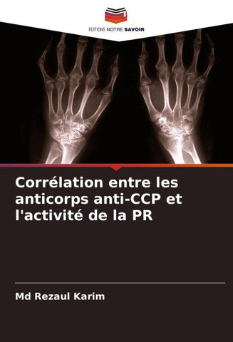 Corrélation entre les anticorps anti-CCP et l'activité de la PR