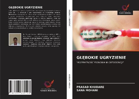 G¿¿BOKIE UGRYZIENIE