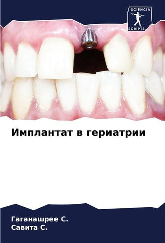 Implantat w geriatrii