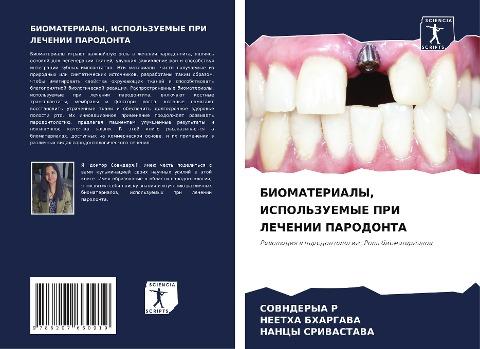 BIOMATERIALY, ISPOL'ZUEMYE PRI LEChENII PARODONTA