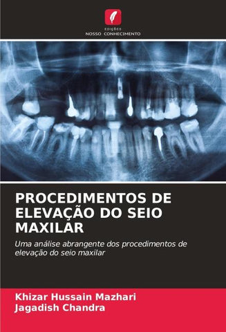 PROCEDIMENTOS DE ELEVAÇÃO DO SEIO MAXILAR