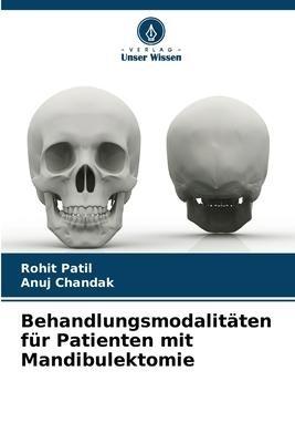 Behandlungsmodalitäten für Patienten mit Mandibulektomie