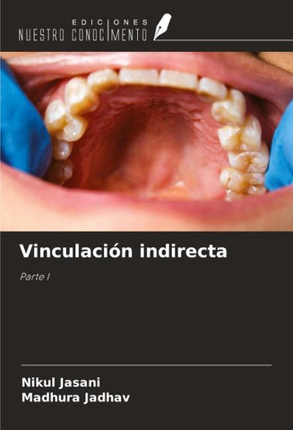Vinculación indirecta