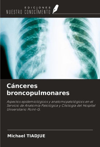 Cánceres broncopulmonares