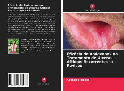 Eficácia da Amlexanox no Tratamento de Úlceras Afthous Recorrentes -a Revisão